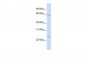 PRDX2 antibody - middle region
